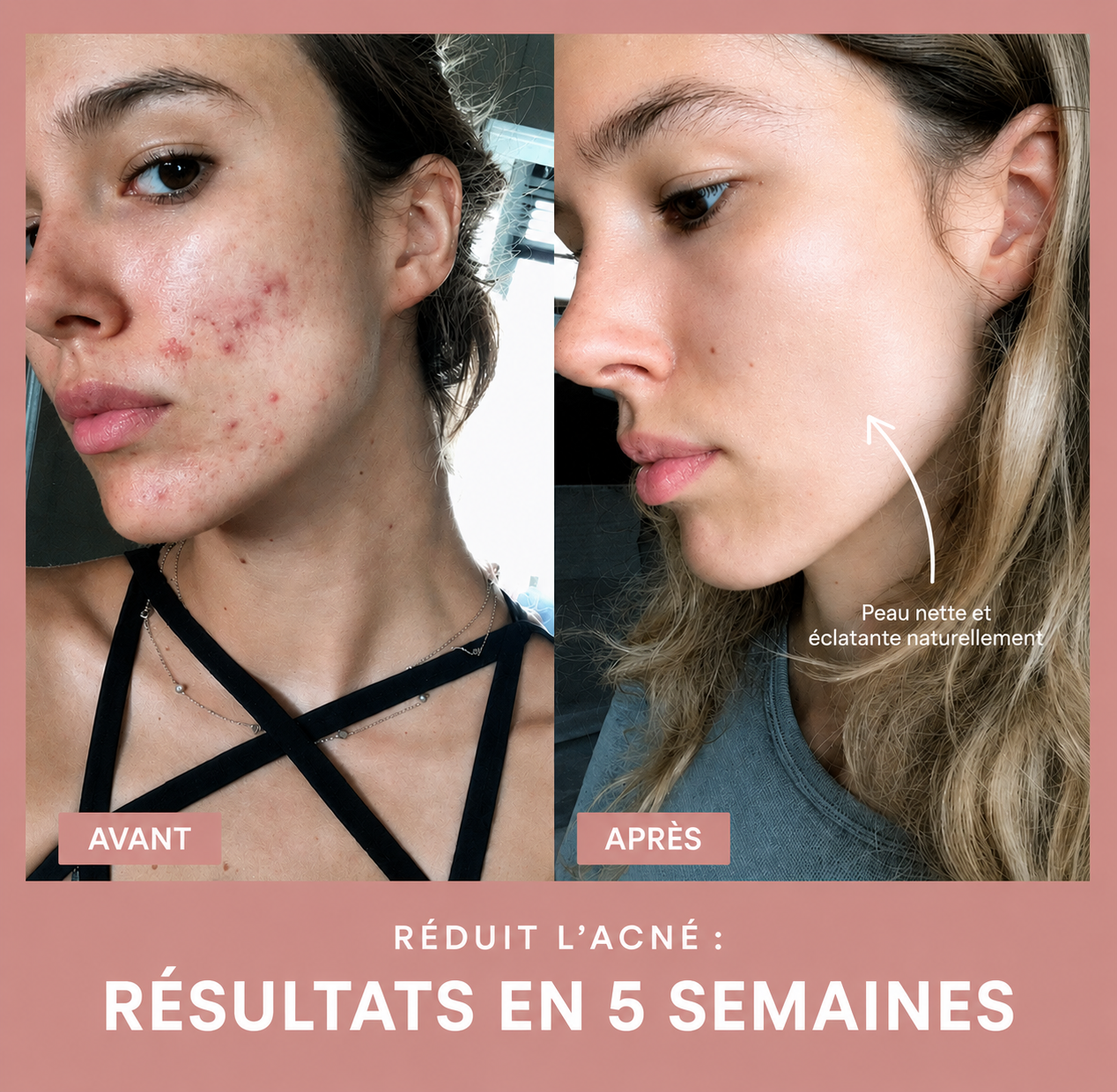 Sculpteur de visage EMS