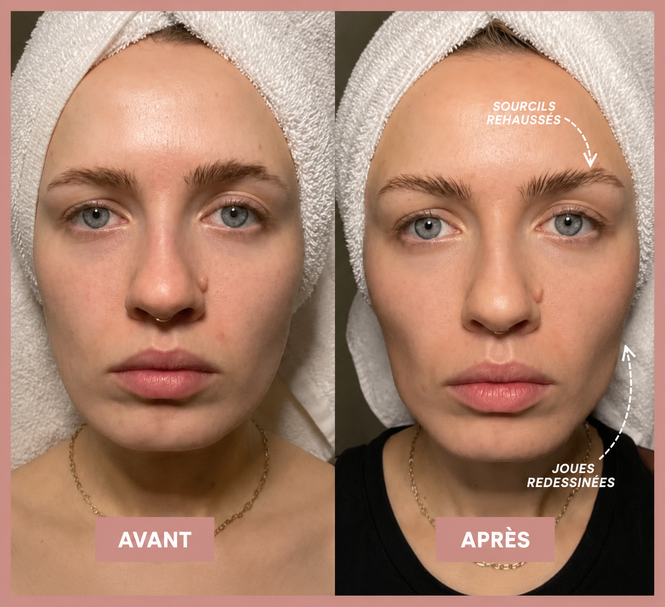 Sculpteur de visage EMS