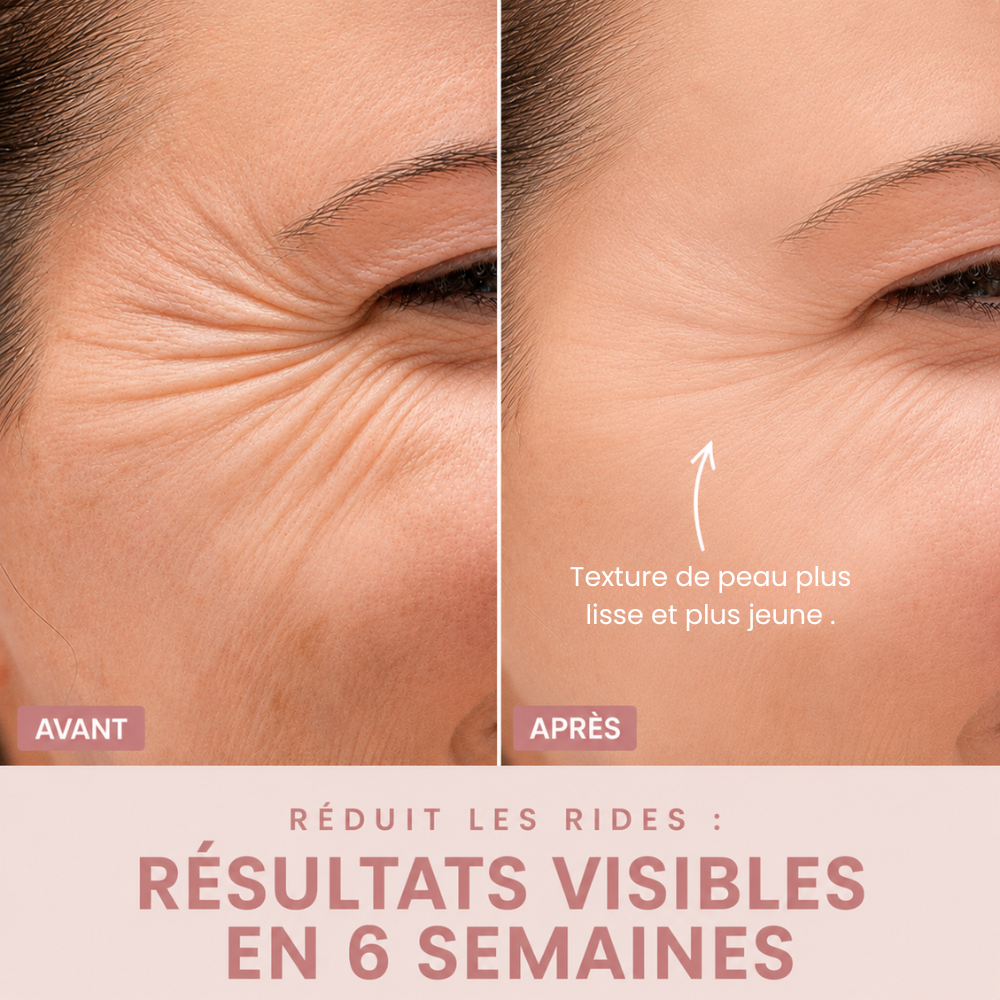Sculpteur de visage EMS